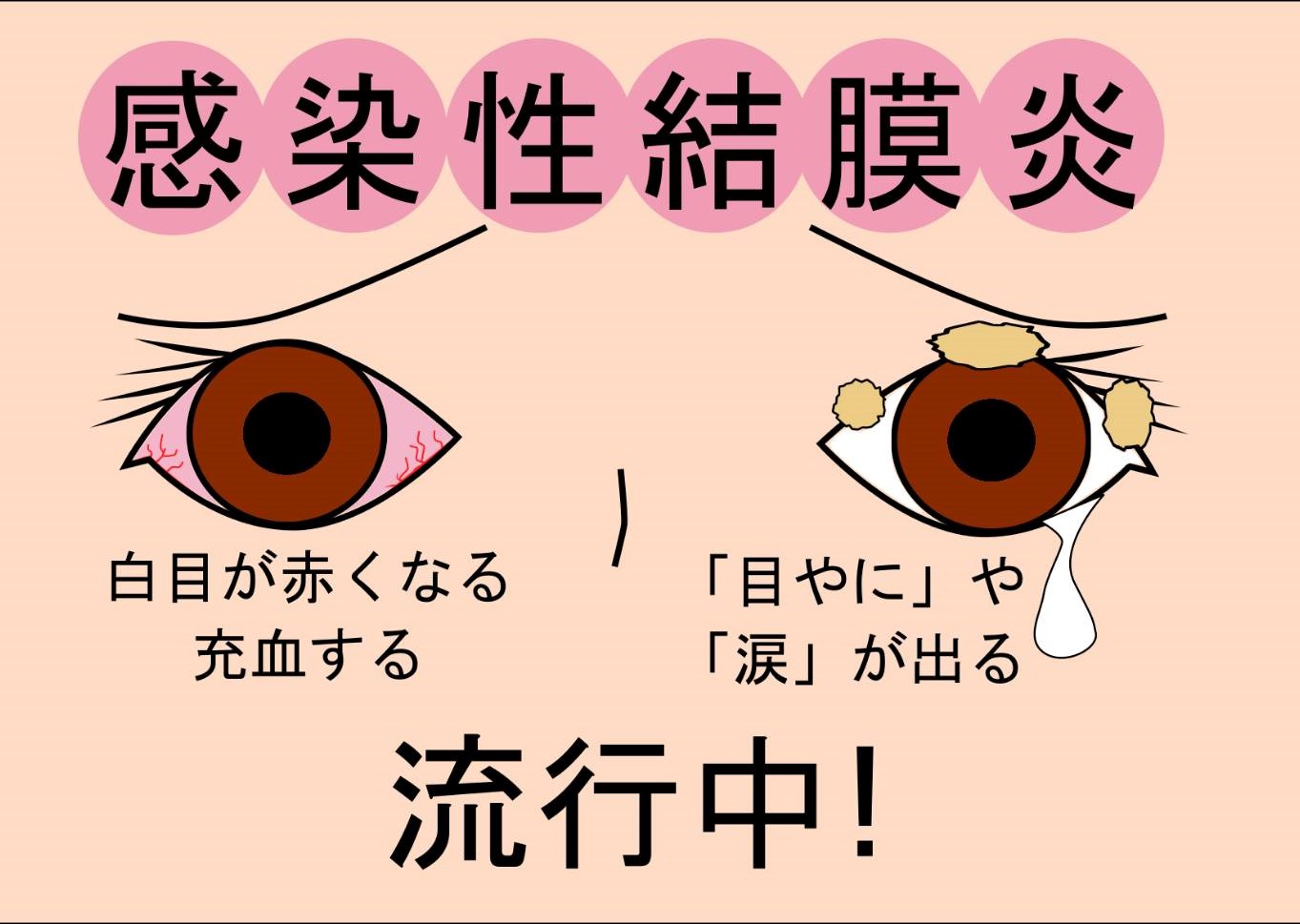 何が原因でしょうか?